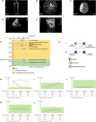 Doubly bi-allelic variants of MTHFR and MTHFD1 in a Chinese patient with hyperhomocysteinemia and failure of folic acid therapy